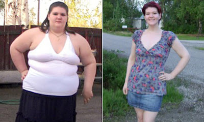 antes e depois de perder peso