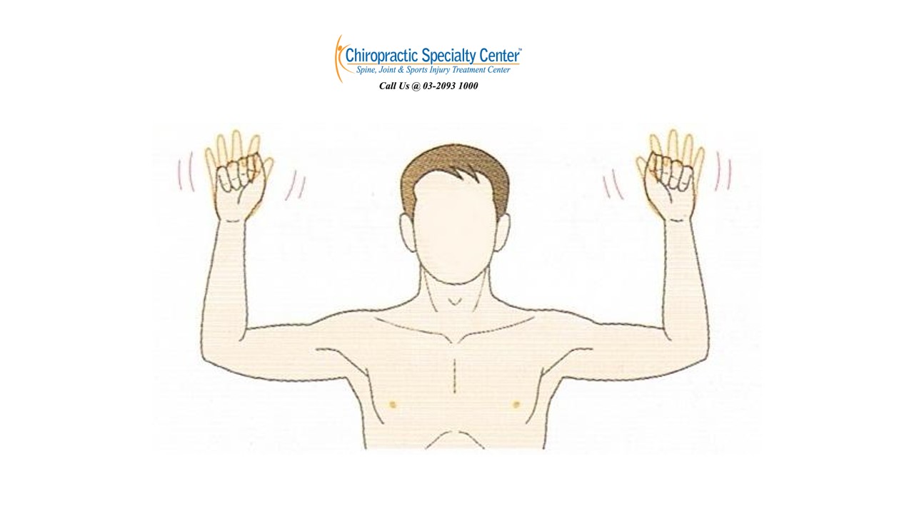 Thoracic Outlet Syndrome Pain Pattern Cool Decorating Thoracic Outlet Syndrome Pain Pattern Cool Decorating