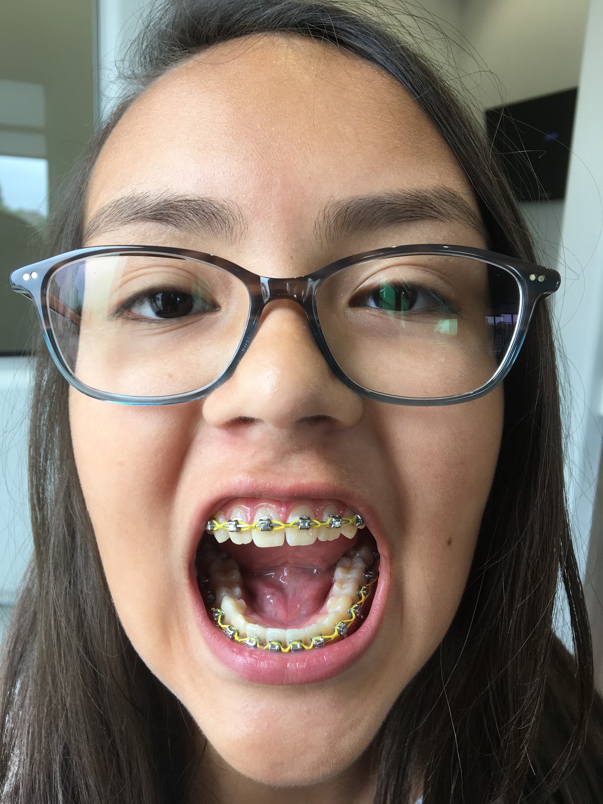 Happiness Is Never Stopping To Think If You Are Shots & Yellow Brace Bands