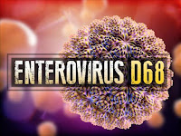 Enfermedades Enterovirus d68