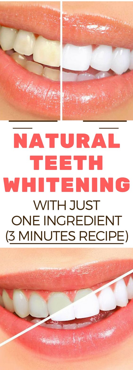 NATURAL TEETH WHITENING WITH JUST ONE INGREDIENT (3 MINUTES RECIPE