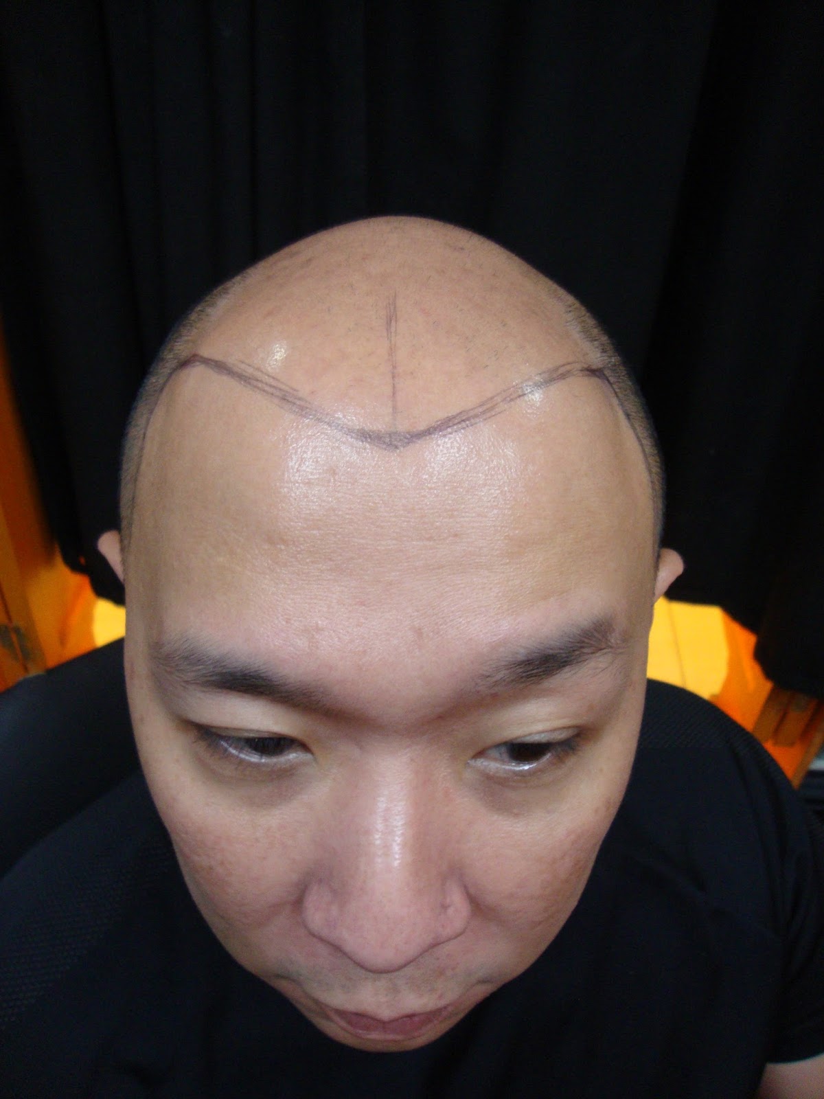 Immortal Tattoo Manila Philippines By Frank Ibanez Jr Scalp
