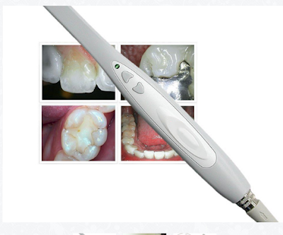 Cámara Intraoral Dental USB-X