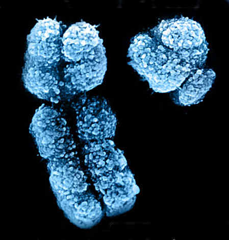 Kromosom XY yang terdapat pada jenis kelamin laki-laki