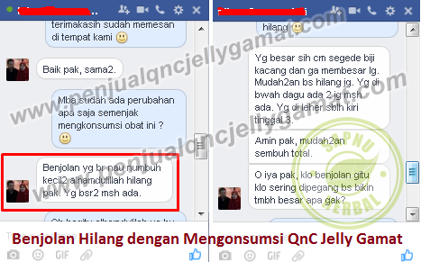 Cara Mengobati Nyeri Buah Zakar Secara Alami Sampai Tuntas Cara Mengobati Nyeri Buah Zakar Secara Alami Sampai Tuntas
