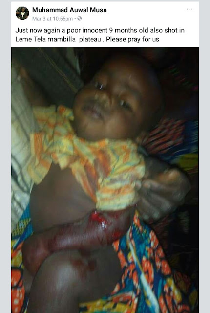  Photo: 9-month-old baby allegedly shot in the communal clash on Mambilla Plateau, Taraba State