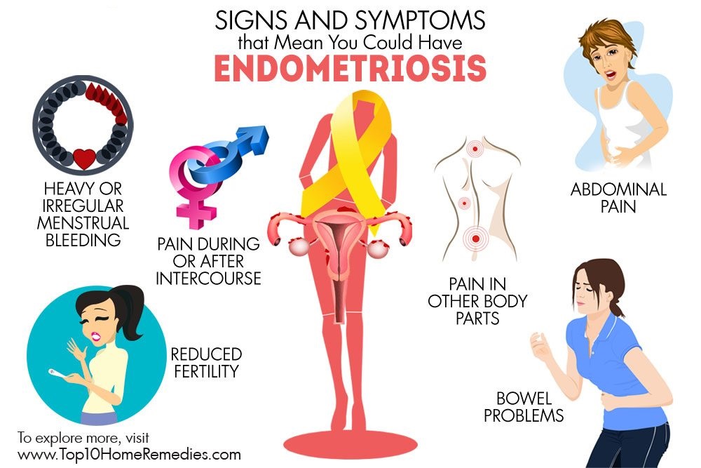 Medicina natural endometriosis