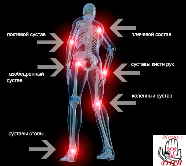 Болезненный хруст в суставах лечение лазером суставов