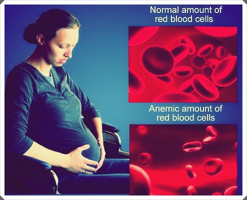 Anemia Pada Kehamilan: Ketahui dan Lawan!