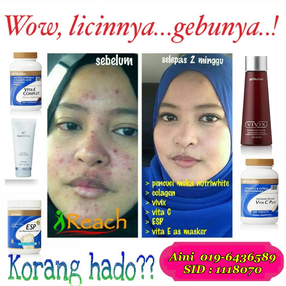 Sihir Buah untuk Kulit Sehat: Memanfaatkan Vitamin A untuk Hadapi Masalah Kulit