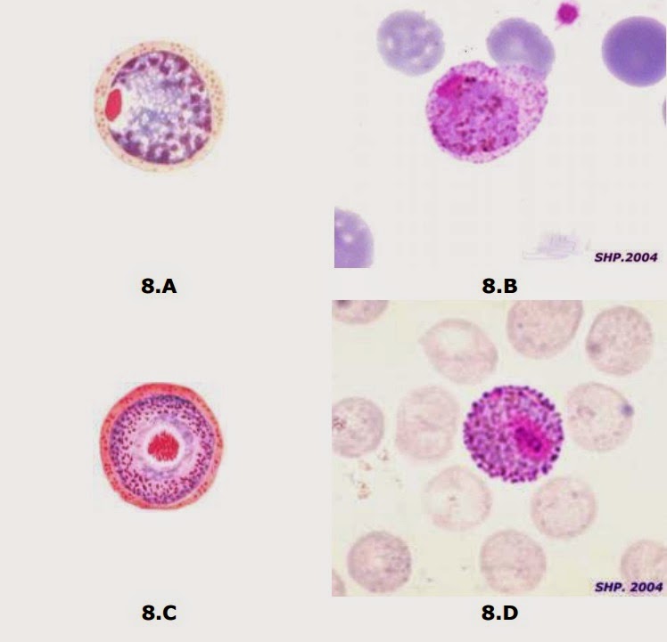 формы существования плазмодия вивакс. плазмодий вивакс. 3. Malariae, p. толстая капля тонкий мазок на малярийный плазмодий.