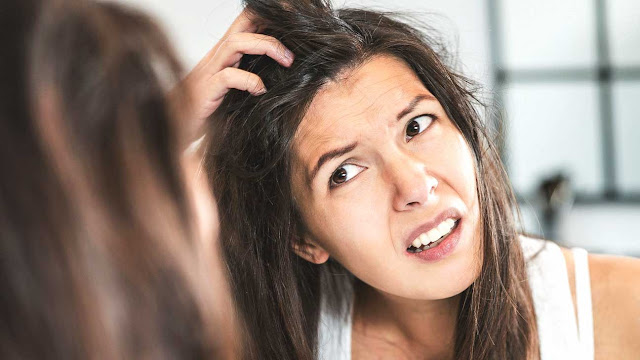 10 Signs You are not Drinking Enough Water, Dandruff 