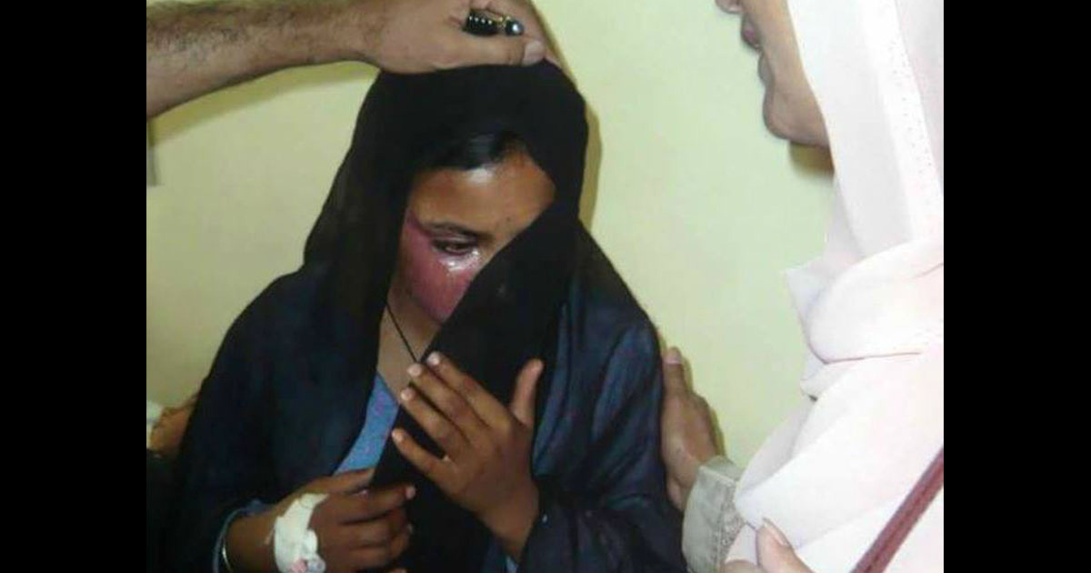 Watch Christian Woman Was Executed By Acid In Pakistan