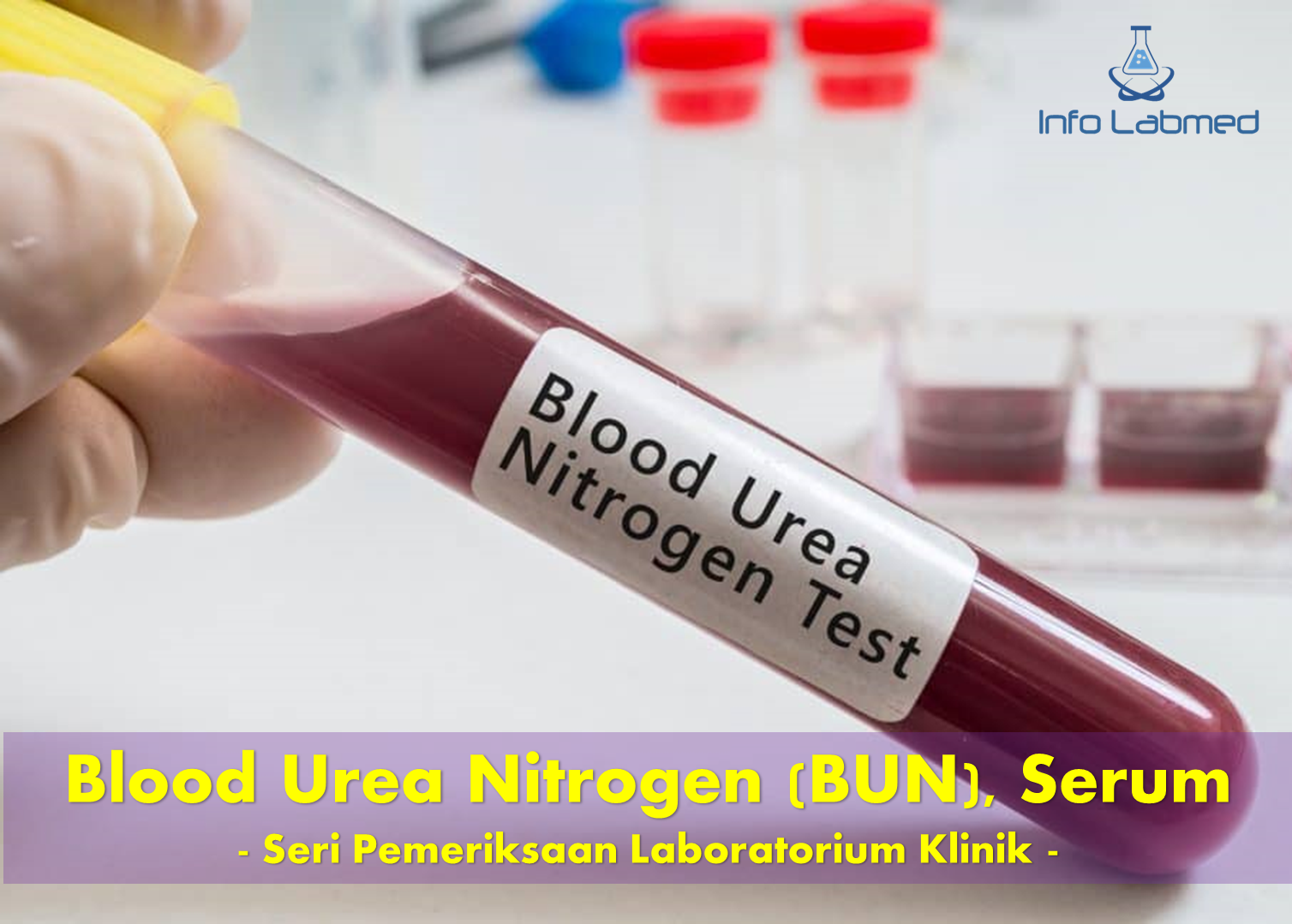 Blood Urea Nitrogen (BUN), Serum Seri Pemeriksaan Laboratorium Klinik