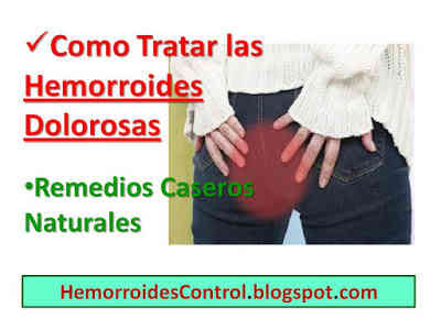 remedios caseros hemorroides embarazo
