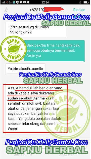 Cara Ampuh Menyembuhkan Gondok Tanpa Operasi Sampai Sembuh Total Cara Ampuh Menyembuhkan Gondok Tanpa Operasi Sampai Sembuh Total