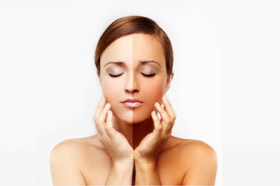 How To Whiten Skin? Skin Whitening Processes : What You Really Need to Know