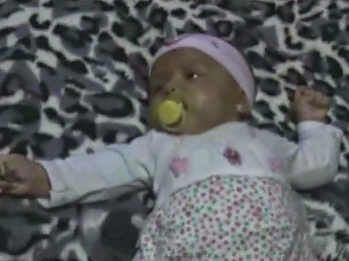 Práctica de reflejos en un neonato Reflejo Tónico del Cuello