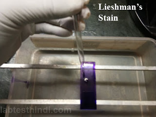 Leishman's stain & Water