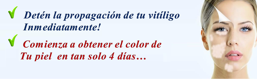 Se Cura El Vitiligo Con Protopic