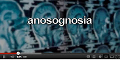 Anosognosia Video