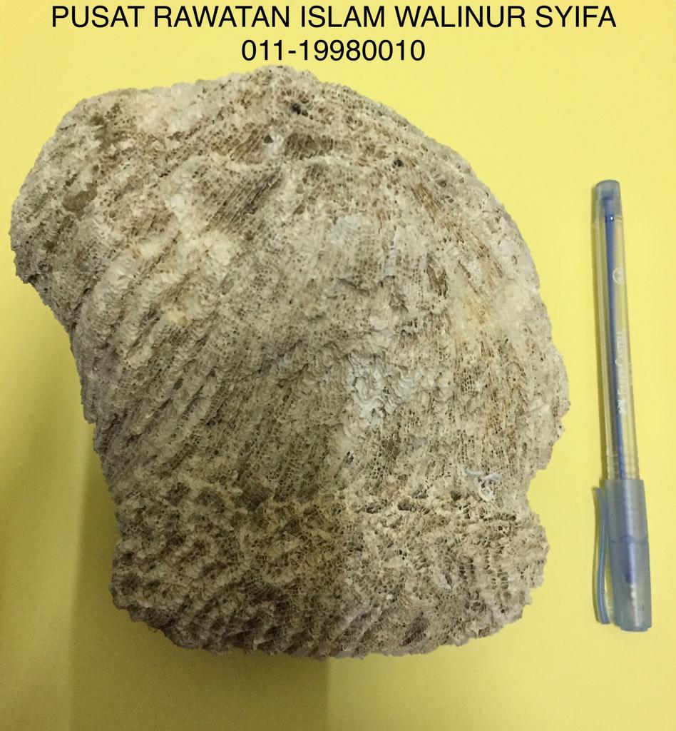 PUSAT RAWATAN ISLAM DAN TRADISIONAL WALINUR SYIFA / WALINUR SYIFA