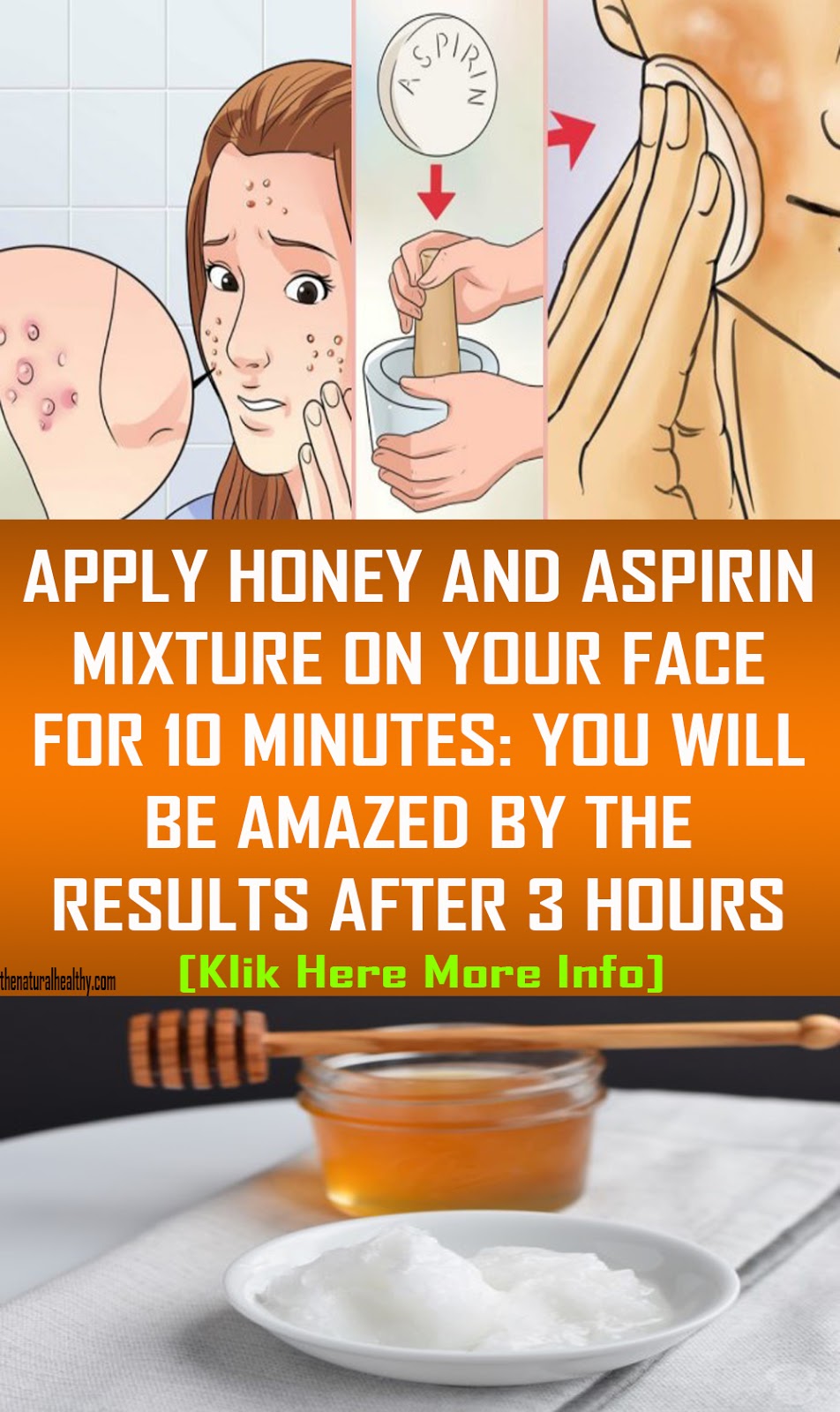 APPLY HONEY AND ASPIRIN MIXTURE ON YOUR FACE FOR 10 MINUTES YOU WILL