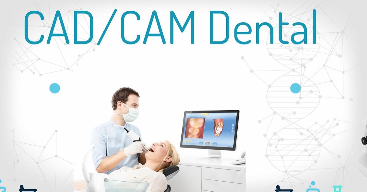 Conoce la tecnología CAD – CAM