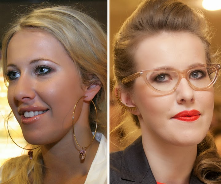 Елена Лядова увеличила губы: фото до и после, Бузова, Кирилл Терешин, Мерьем Узе