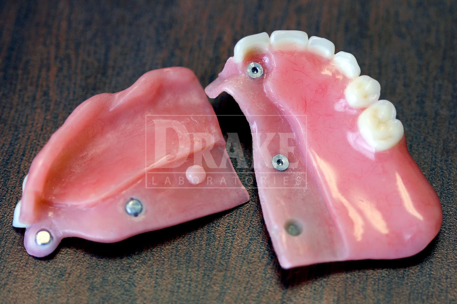 and hinges and dentures, OH MY!