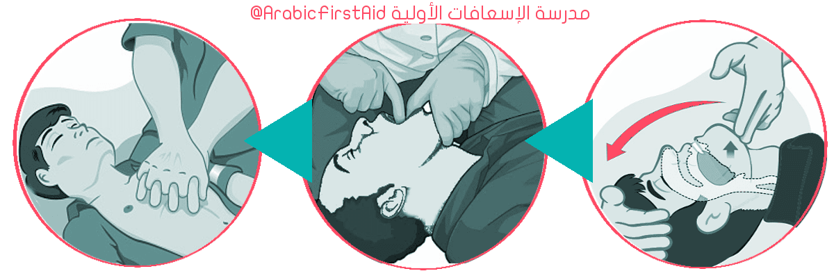 First-aid-choking-unconscious