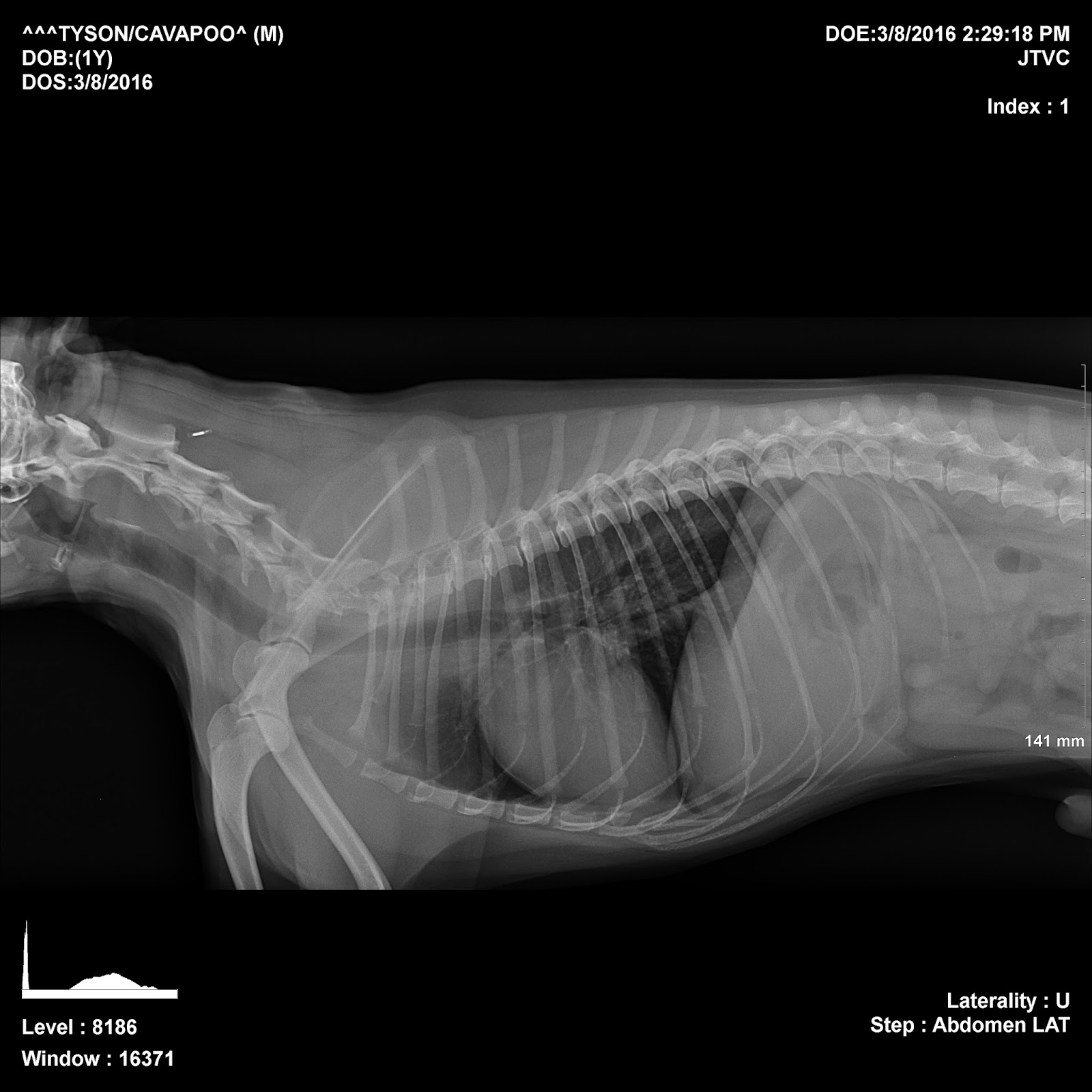 List 92+ Wallpaper Pictures Of Blood In Vomit Full HD, 2k, 4k 11/2023