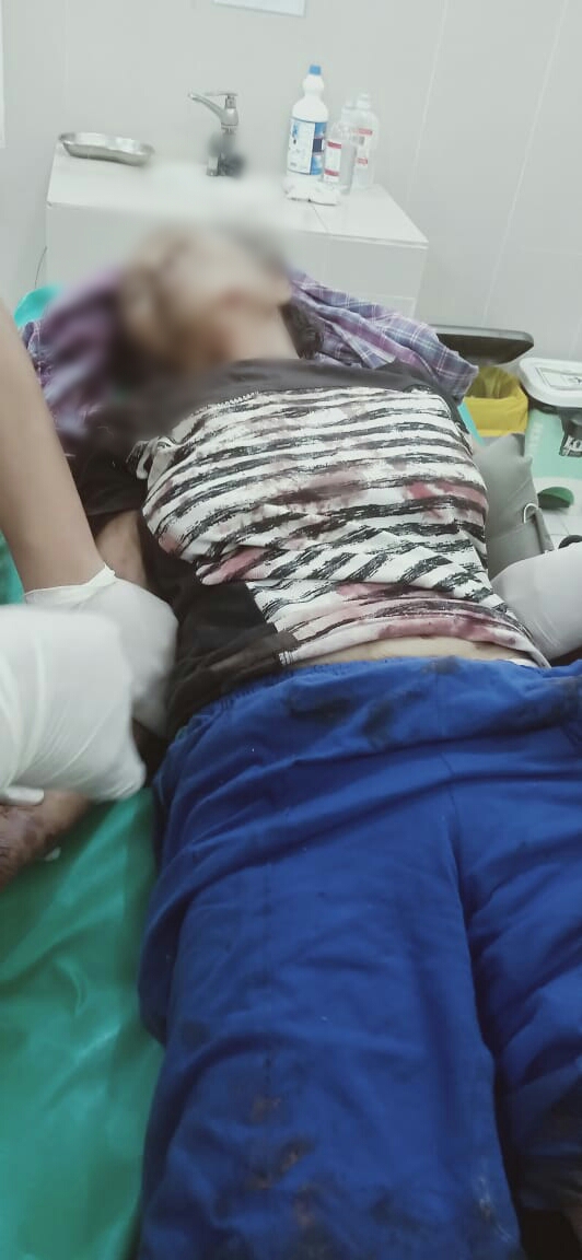 Dibacok Pencuri, Nenek Umur 79 Tahun ini Berlumur Darah
