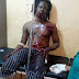 Native doctor ends up in hospital after he asks someone to shoot him in a bid to show off his powers(Photos)