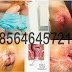 Antihemoroid AmbeJOSS Zaitop Obat Wasir thumbnail