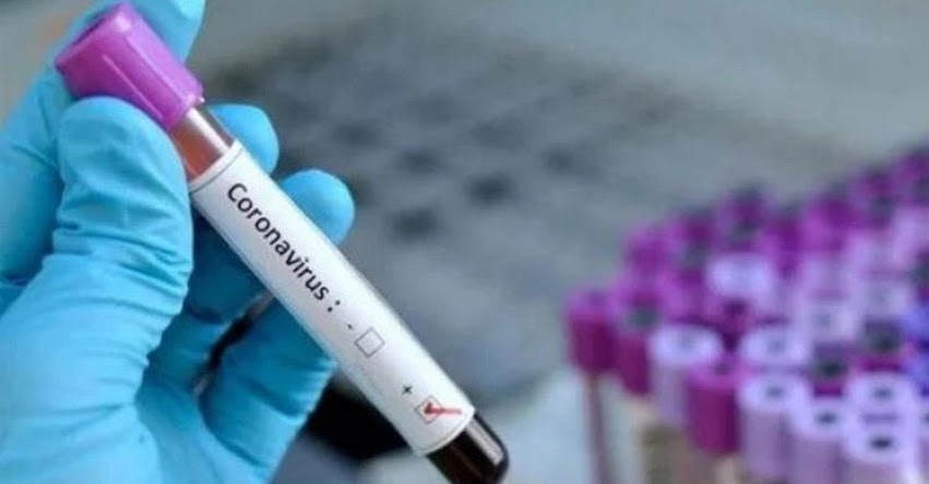 CORONAVIRUS EN PERÚ: Aumentan a 10 los casos confirmados en La Libertad CORONAVIRUS EN PERÚ: Aumentan a 10 los casos confirmados en La Libertad