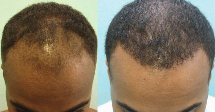 Black American Style Men Hair 2016 Latest Ellecrafts