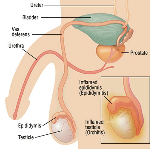 what std causes swollen testicles what std causes swollen testicles