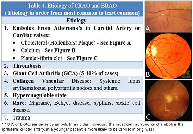 central retinal artery occlusion vs normal