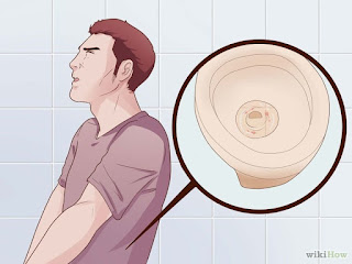 Keluar Cairan Putih Dari Penis Keluar Cairan Putih Dari Penis