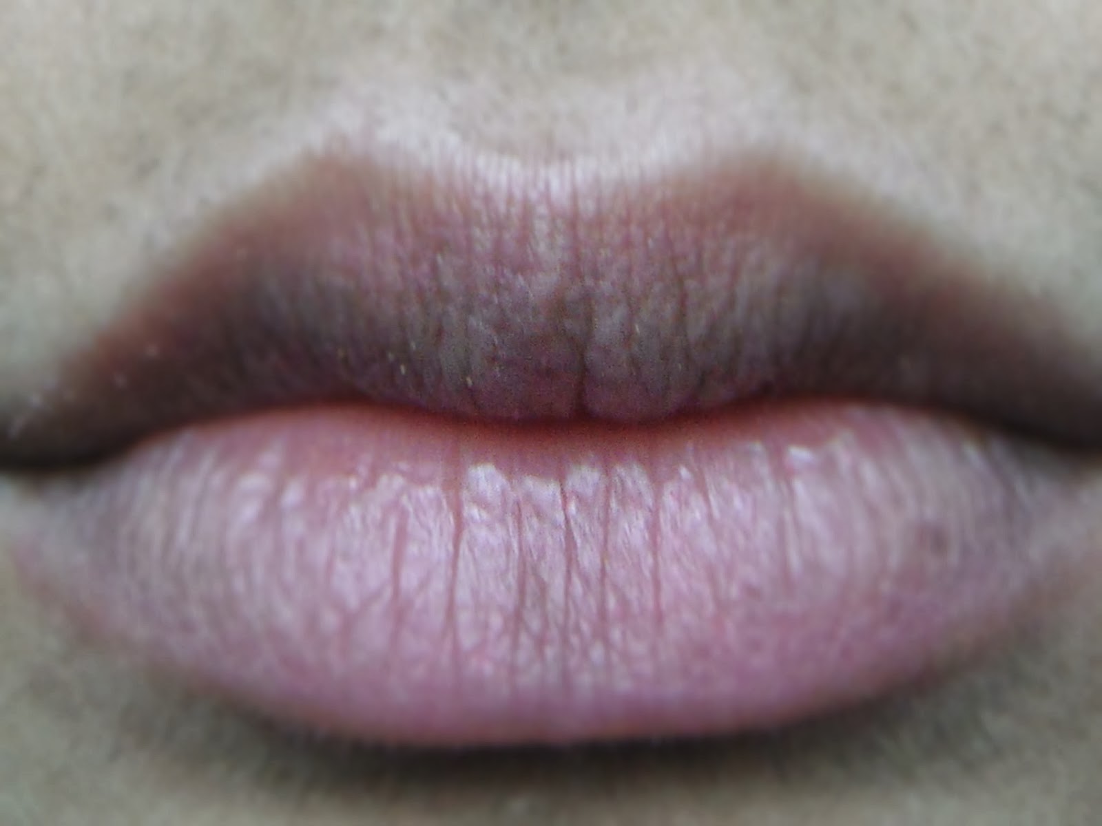 Beauty In The Third World Carmex lip balm review and beforeafter!