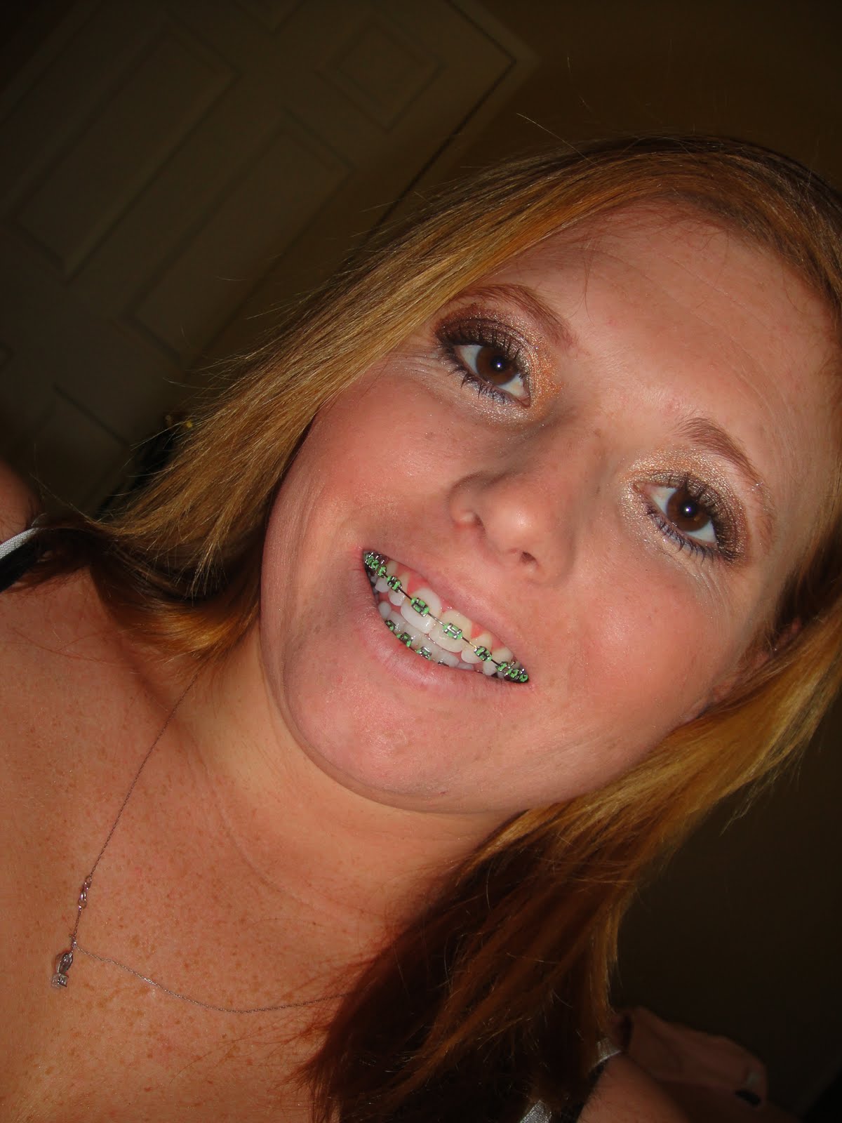 braces month getting