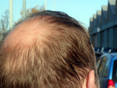 Bald Spot Picture One