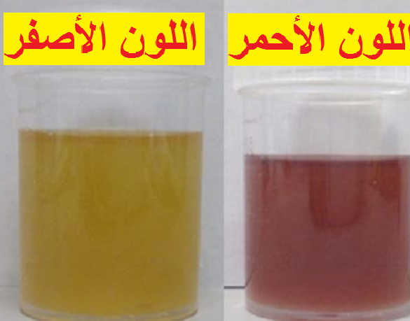 يهلك البارود هذا كل شئ البول الاحمر عند النساء Cedarmantel Com