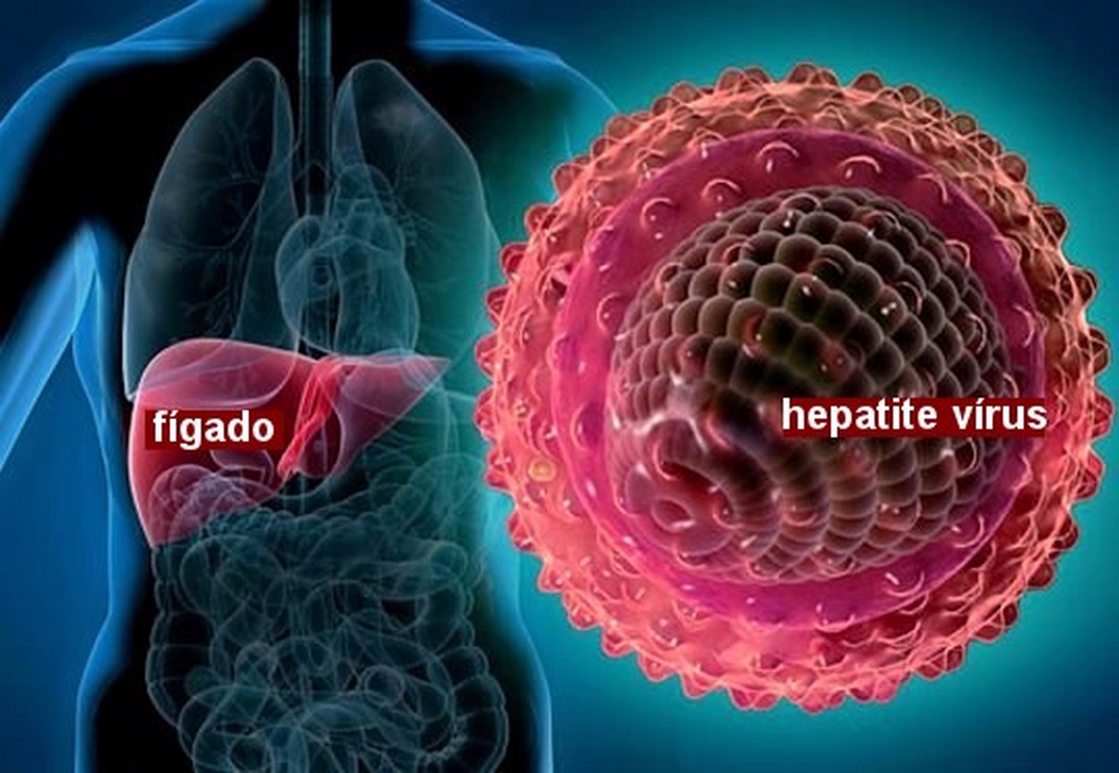 Hepatite sintomas, tratamentos e causas
