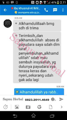 Cara Menyembuhkan Radang Payudara (Mastitis) Saat Menyusui Cara Menyembuhkan Radang Payudara (Mastitis) Saat Menyusui