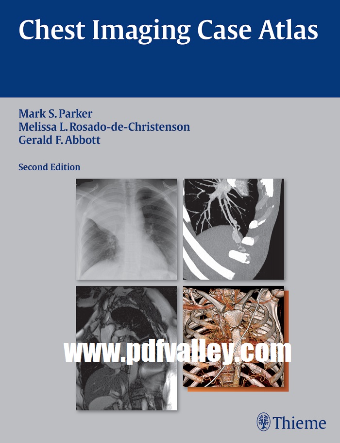 Chest Imaging Case Atlas 2nd Edition