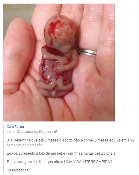 o aborto é uma MERDA!!