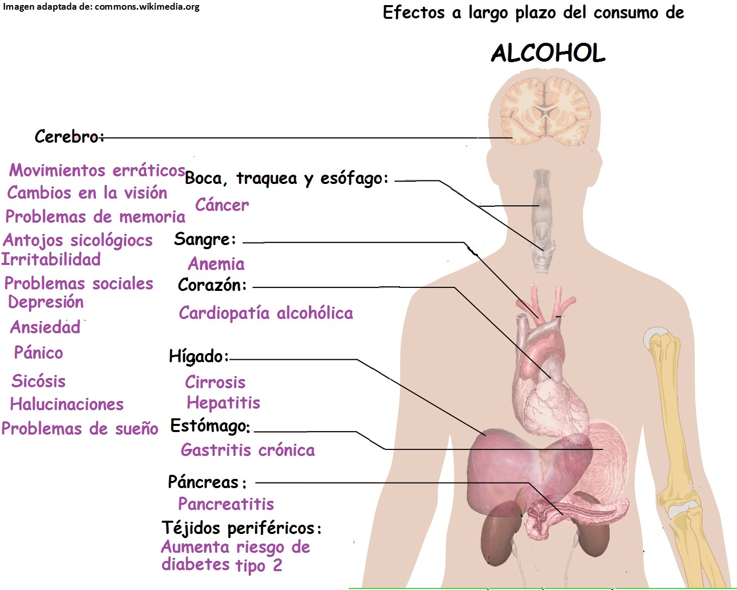 Los síntomas de la degradación de la persona al alcoholismo