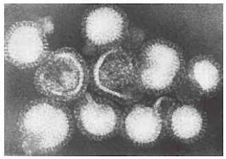 Transmission electron micrograph of influenza virus A. (From Winn WC Jr, Allen S, Janda W, et al. Koneman’s Color Atlas and Textbook of Diagnostic Microbiology. 6th ed. Philadelphia, PA: Lippincott Williams & Wilkins; 2006.) Transmission electron micrograph of influenza virus A. (From Winn WC Jr, Allen S, Janda W, et al. Koneman’s Color Atlas and Textbook of Diagnostic Microbiology. 6th ed. Philadelphia, PA: Lippincott Williams & Wilkins; 2006.)